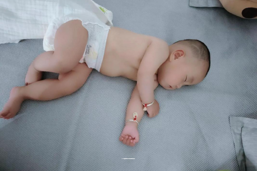 章丘六个月宝宝眼睛散光